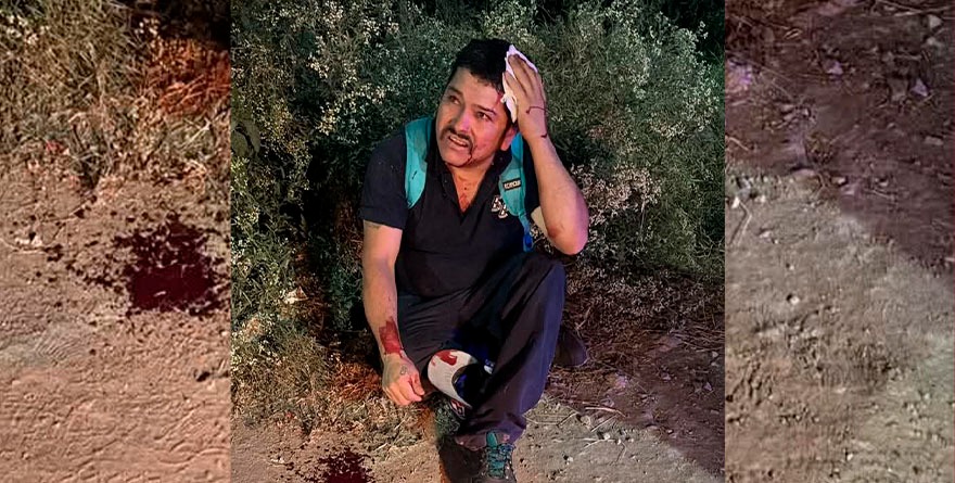 Asaltan con machete en Periférico