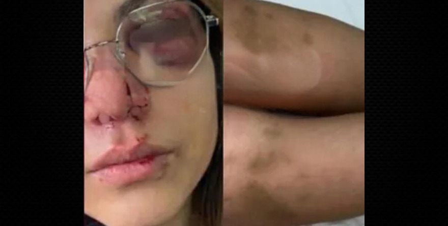 UASLP ignoró 57 días agresión a ex alumna