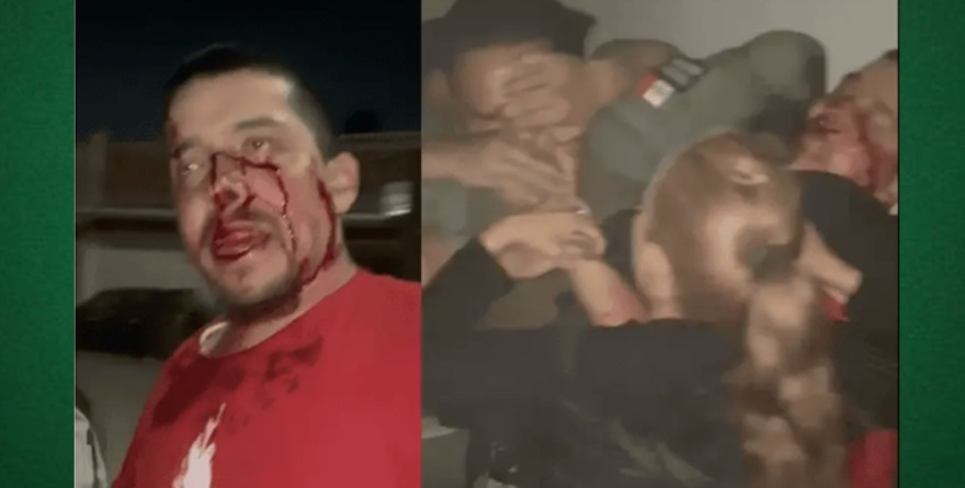 Se pone violento y ataca a policías en Villa Alborada