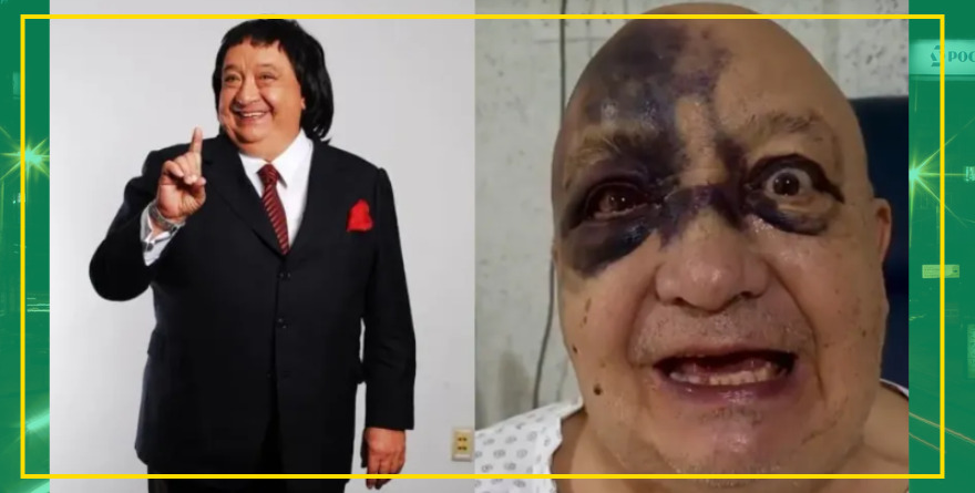 ¡Qué le pasó a Luis de Alba!