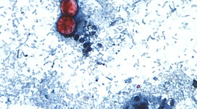 ¿QUÉ PROVOCA LA CICLOSPORIASIS Y CÓMO SE CONTAGIA?