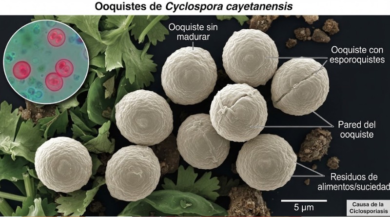 EXPONE CICLOSPORIASIS EN EU FALLAS EN RASTREO DE ALIMENTOS